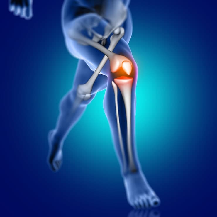 Physiotherapist helping knee replacement patient with exercises at home in Pune