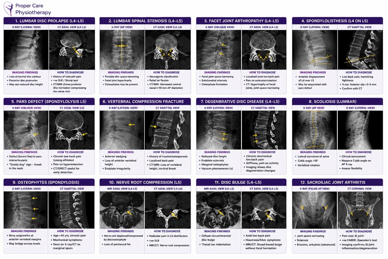 xray ct spine findings
